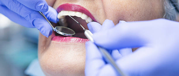Best Emergency Tooth Extraction in Clinton, UT